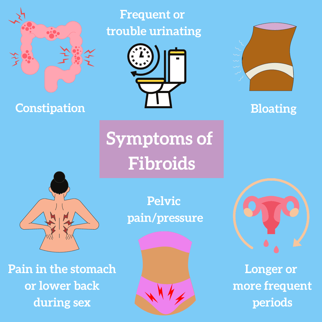 Symptoms of Fibroids 1