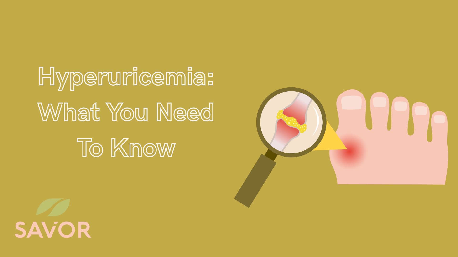 Hyperuricemia: What You Need To Know